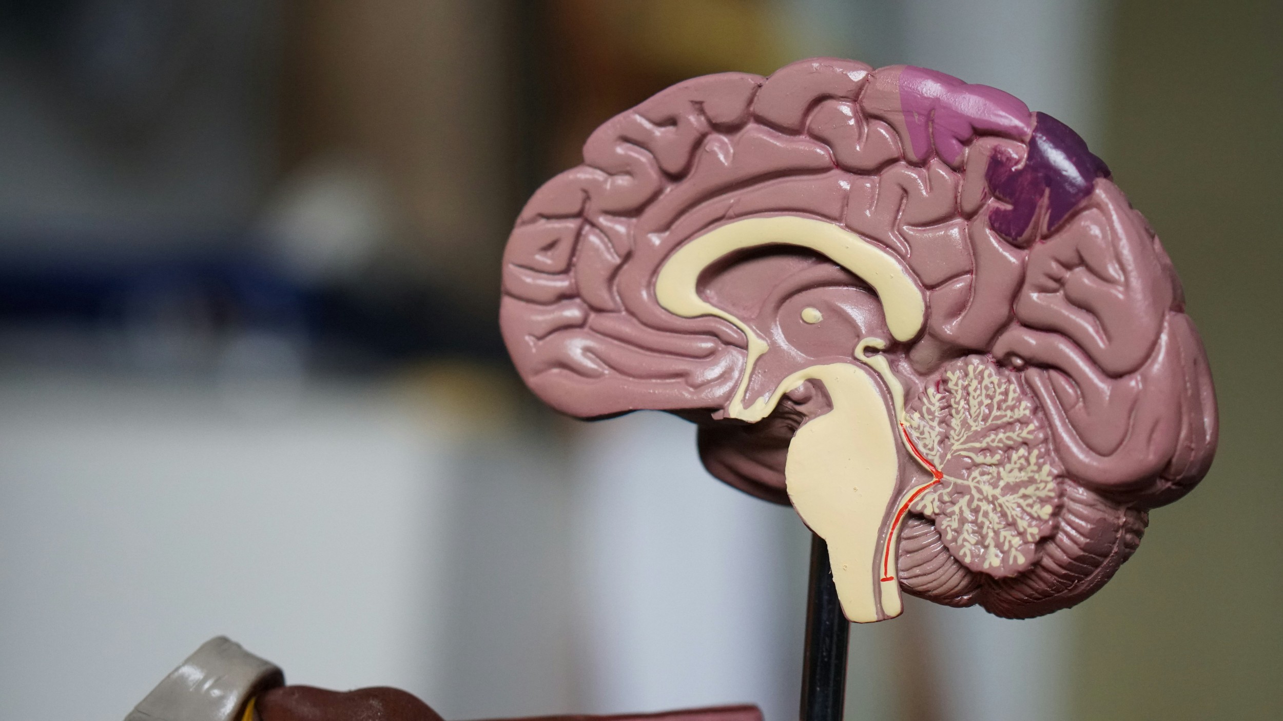 The Tessa Jowell New to Neuro-Oncology Course
